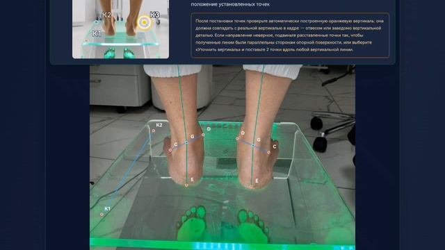 Подсказки по расстановке ориентиров на снимке голеней в RSTCTECH, кадр видео